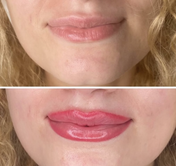 Dark Lip Neutralization - Image 2